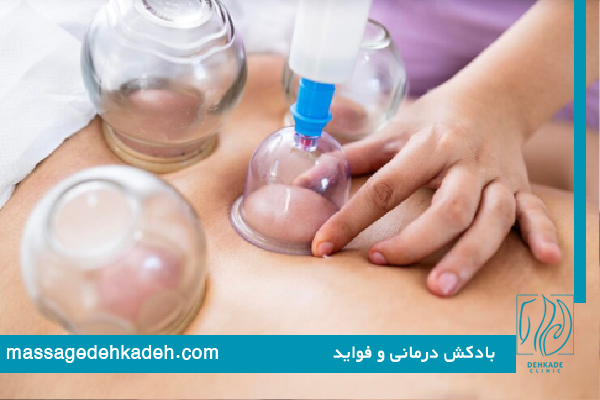 بادکش درمانی چیست