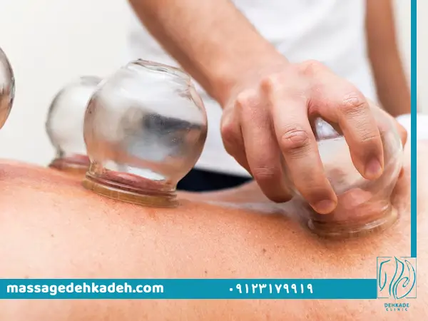 بادکش درمانی در کرج