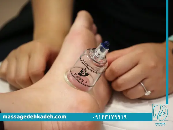 بادکش درمانی در کرج